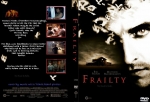 Frailty